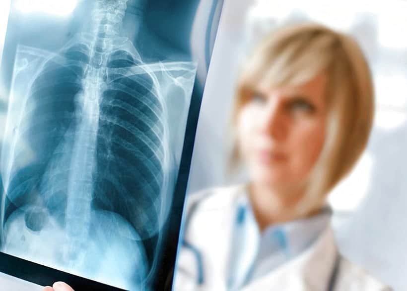 С 16 по 22 ноября в Чувашии пройдет Неделя здоровых легких.