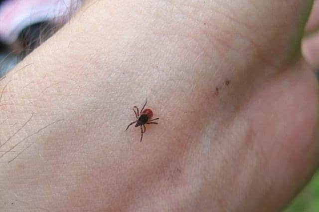 За 9 месяцев в Канаше зарегистрировано 51 обращение по поводу присасывания клещей.