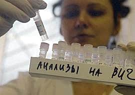 В Чувашии возросла заболеваемость ВИЧ-инфекцией на 37,7%.