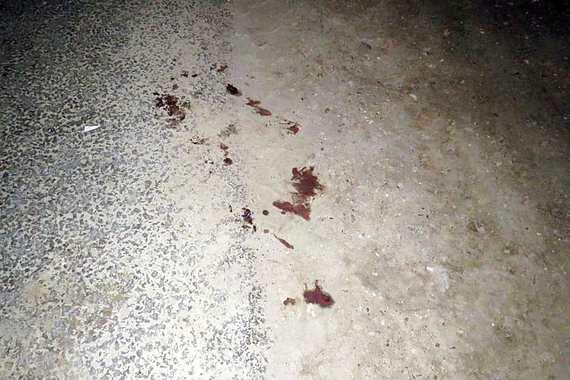 Полицейские нашли автомобиль, на котором сбили 69-летнего мужчину на трассе возле Шихазан.