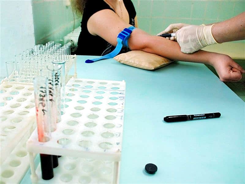 Самый высокий уровень заболеваемости ВИЧ-инфекцией зафиксирован в Канаше.