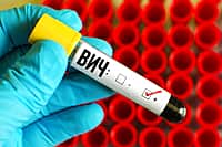 О ситуации заболеваемости ВИЧ – инфекцией за 10 месяцев 2025 года по отделу Управления по г  Канаш.