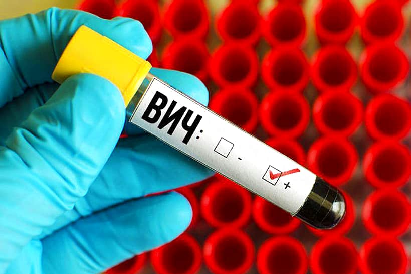 О ситуации заболеваемости ВИЧ – инфекцией за 10 месяцев 2025 года по отделу Управления по г Канаш.